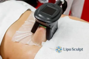 Cryolipolysis Helping You Getting that Perfect Summer Body 3 Cryolipolysis Bibury can give you the best summer body - contact us today!