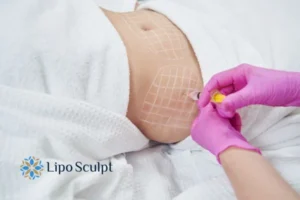 Are The Results From Aqualyx Permanent? 1 Do you want to know how long Aqualyx Bibury results last?